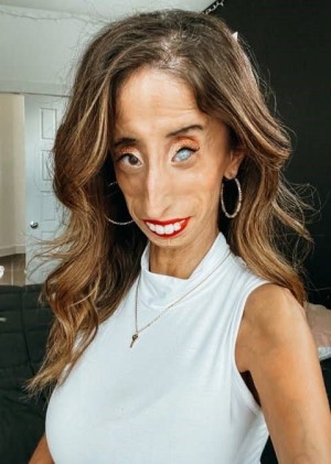 Lizzie Velasquez